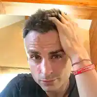 Бербо не спира да се гали по присадената коса, не може да й се нарадва