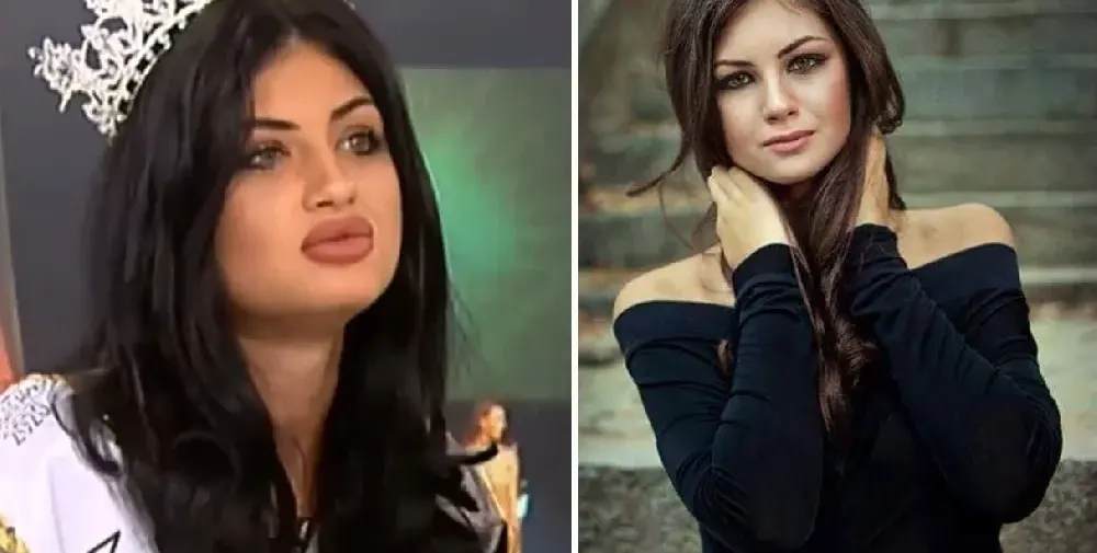 Да! Красавицата в дясно е новата Мис България, преди да издуе джуки (Снимки)