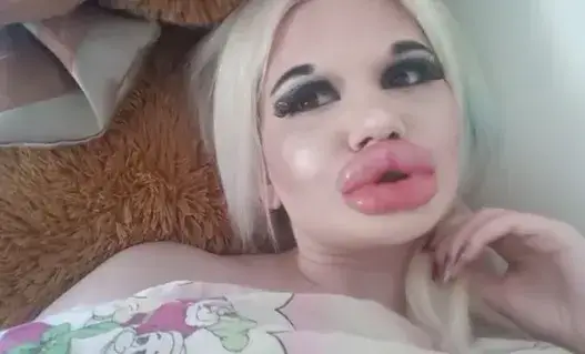 Бг Барби с 22-ра операция за ЧНГ! (Американци я канят в шоу, за да я покажат на целия свят)