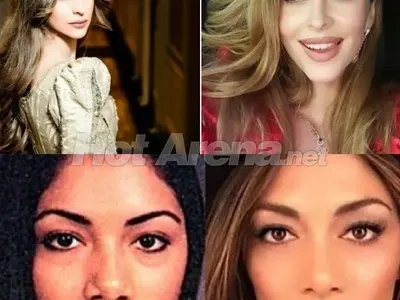 И Никол с нов нос като Лолита (Двете на Гришо са се оперирали в Лос Анджелис)