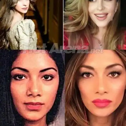 И Никол с нов нос като Лолита (Двете на Гришо са се оперирали в Лос Анджелис)