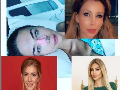 Клъцни-срежи! Кои родни звезди си оперираха носовете през 2020 (Подробности)