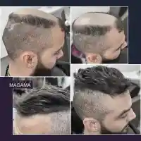 Модерна визия за мъжете с плешивост и оредяла коса от Магама (ВИДЕО)