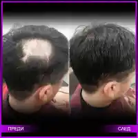 Модерна визия за мъжете с плешивост и оредяла коса от Магама (ВИДЕО)