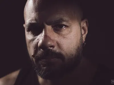 След спортен инцидент: Сглобиха носа на Николай  Попов  от „Обратен ефект“ (Снимки)