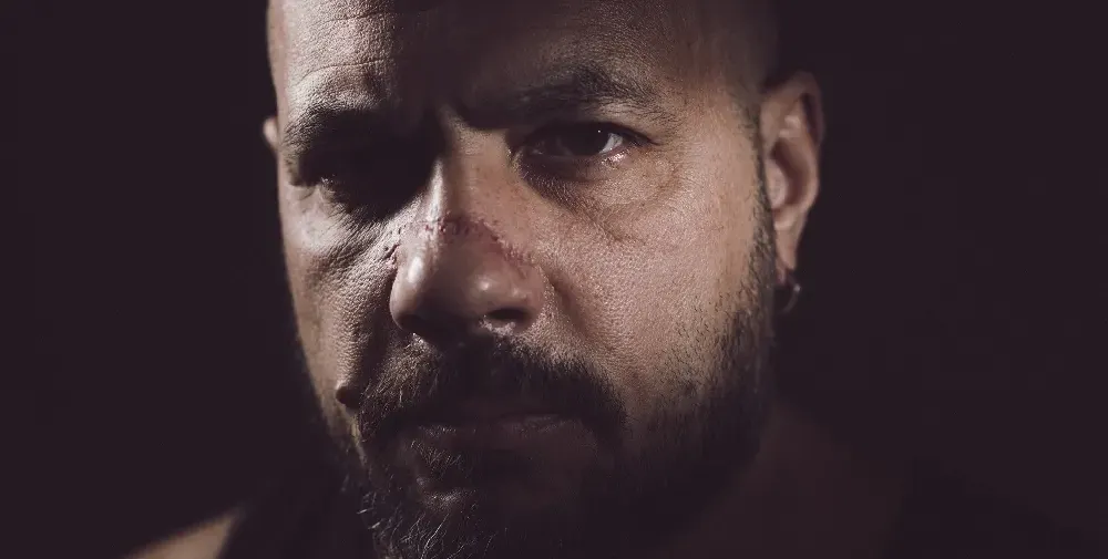 След спортен инцидент: Сглобиха носа на Николай  Попов  от „Обратен ефект“ (Снимки)