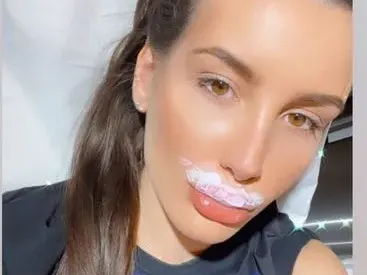 Некадърен лекар окепази джуките на щерката на Фатик