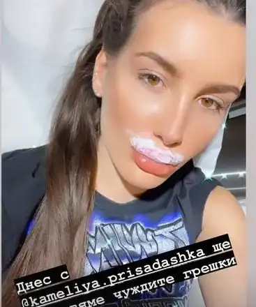 Некадърен лекар окепази джуките на щерката на Фатик