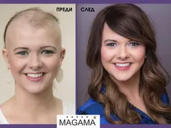 Решения за алопеция в салон Магама (Снимки)