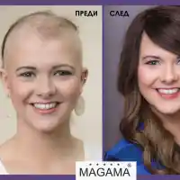 Решения за алопеция в салон Магама (Снимки)