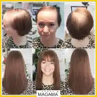 Решения за алопеция в салон Магама (Снимки)