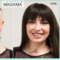 Решения за алопеция в салон Магама (Снимки)