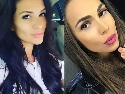 Ваксината рискова за Преслава и Алисия заради филъри в лицето