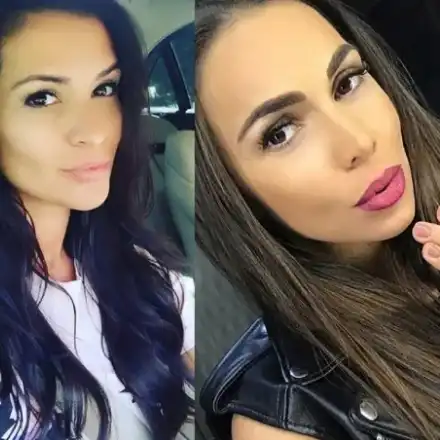 Ваксината рискова за Преслава и Алисия заради филъри в лицето