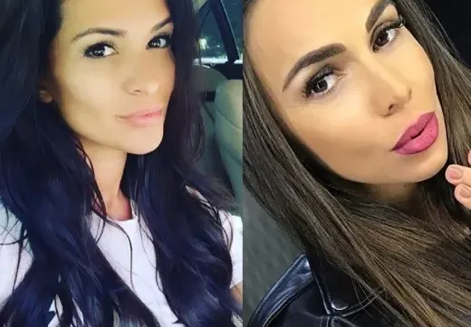 Ваксината рискова за Преслава и Алисия заради филъри в лицето