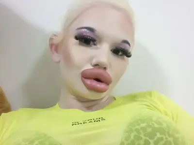 БГ Барби  шокира с 1200 кубика силикон в пазвата