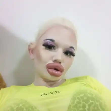 БГ Барби  шокира с 1200 кубика силикон в пазвата