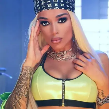 Диона с ботокс във веждите