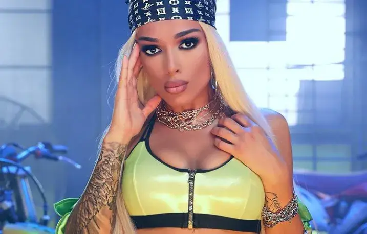 Диона с ботокс във веждите