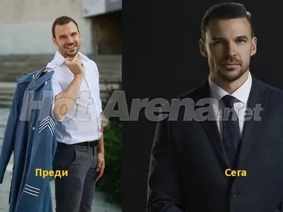 И Ивайло Захариев си присади коса