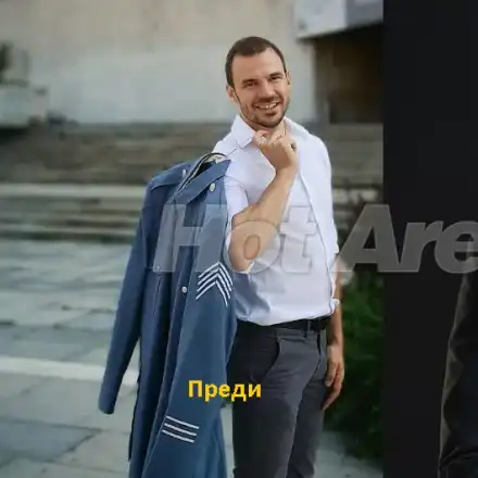 И Ивайло Захариев си присади коса