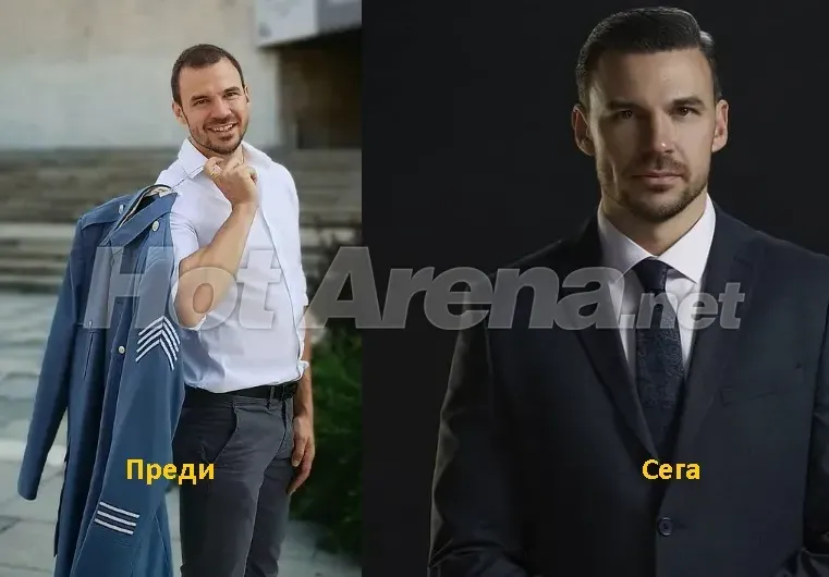 И Ивайло Захариев си присади коса