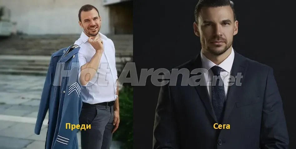 И Ивайло Захариев си присади коса