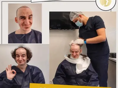 И той като Дани Петканов! Ники Станов си присади коса