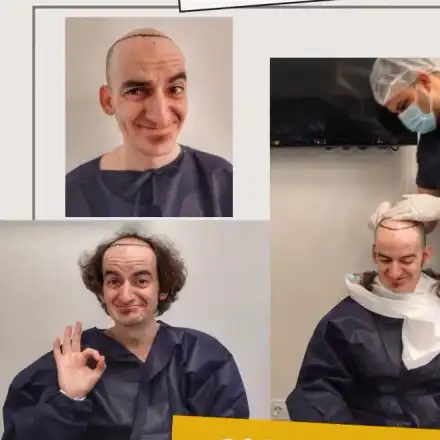 И той като Дани Петканов! Ники Станов си присади коса