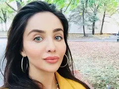 Елен Колева си смени лицето! Вижте какви пластики има