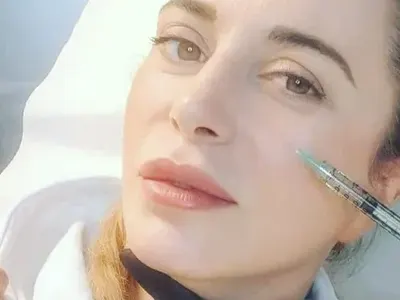 50-годишната Ваня Щерева се наблъска с филъри и ботокс за младото гадже