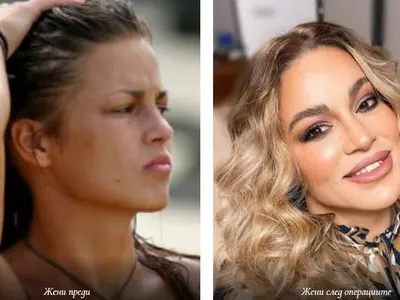 Жени Джаферович сложи филъри (Фото Преди и сега)