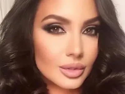 Наталия Гуркова се освежи с ботокс