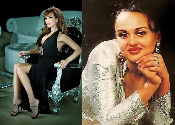 ШОК! Глория преди пластичните операции