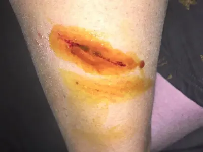 Улично куче НАХАПА Йоко Захариев! Болници отказват да й помогнат (ФОТО)