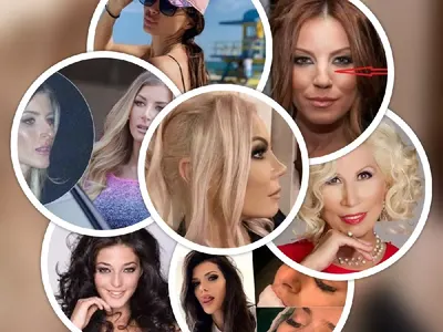 Чалгата се завръща на участия с нови носове: Емилия се кръцна след катастрофа, Преслава се обезобрази в Турция и още…