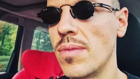 Даниел Петканов остана без зъби