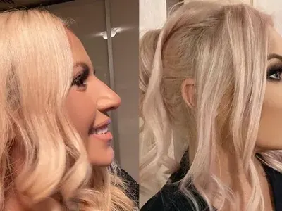 Гаврят Камелия за новия й нос: Чипоноска от Чипровци