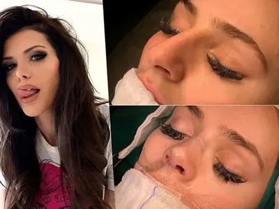 Клонингите АТАКУВАТ! Чалга вирус заразява наред, реже носове (СНИМКИ)