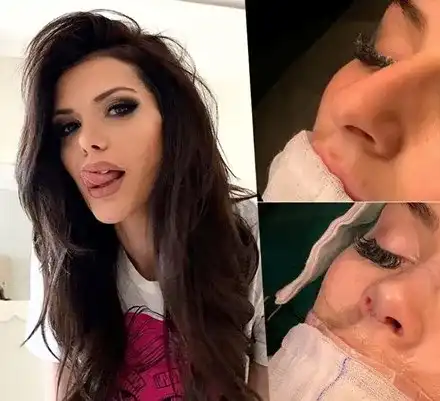 Клонингите АТАКУВАТ! Чалга вирус заразява наред, реже носове (СНИМКИ)