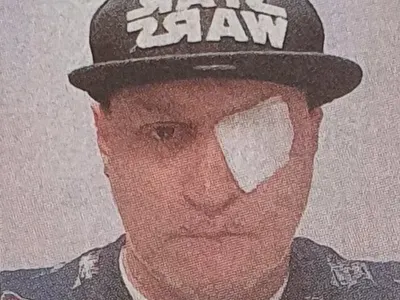 Оперираха окото на DJ Марти Джи