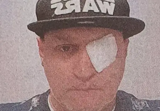 Оперираха окото на DJ Марти Джи