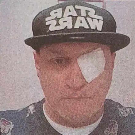 Оперираха окото на DJ Марти Джи