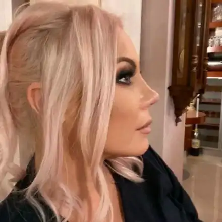 Сагата с носа на Камелия продължава с нова сила