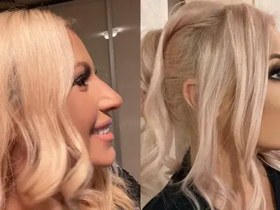 След ринопластиката на Преслава, феновете пак са в шок:  Камелия, защо?