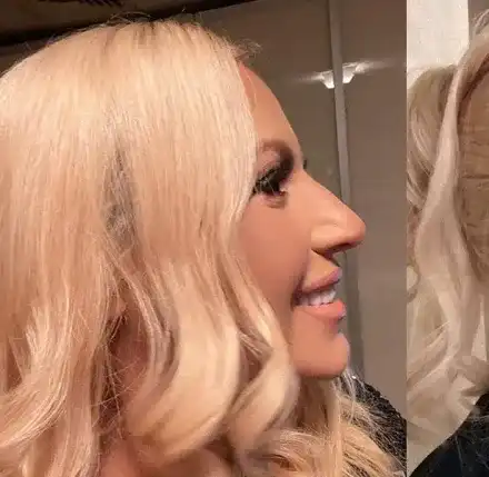 След ринопластиката на Преслава, феновете пак са в шок:  Камелия, защо?