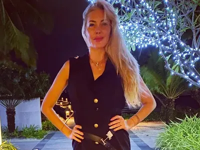 Toца заприлича на жената-котка, поду се от филъри и ботокс