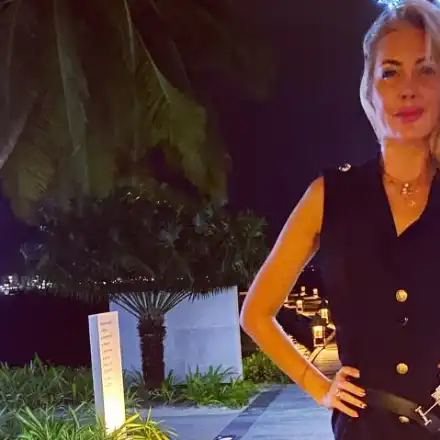 Toца заприлича на жената-котка, поду се от филъри и ботокс