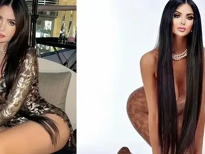 500 пъти си опъва лицето новата Ким Кардашиян