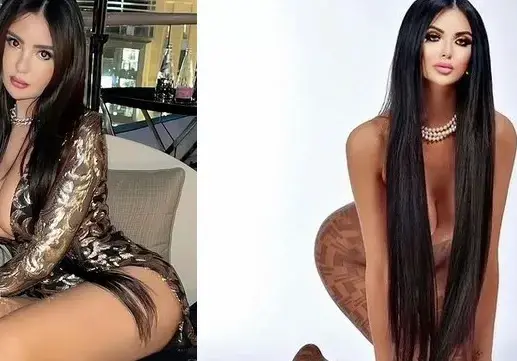 500 пъти си опъва лицето новата Ким Кардашиян